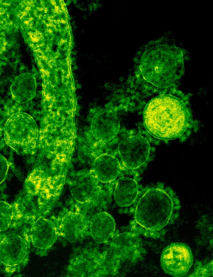 Pseudomonas aeruginosa fue descubierta en el suelo de la Amazonía.